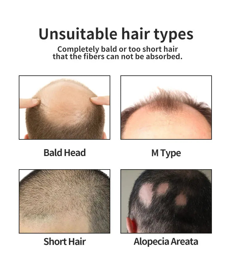 "BUNEE Hair Fiber Set 15g: Men's natural hair-dense fibers for balding areas, fills part lines, includes 15g fiber powder