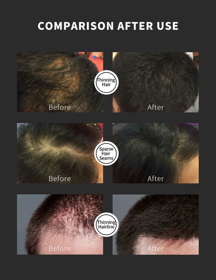 "BUNEE Hair Fiber Set 15g: Men's natural hair-dense fibers for balding areas, fills part lines, includes 15g fiber powder