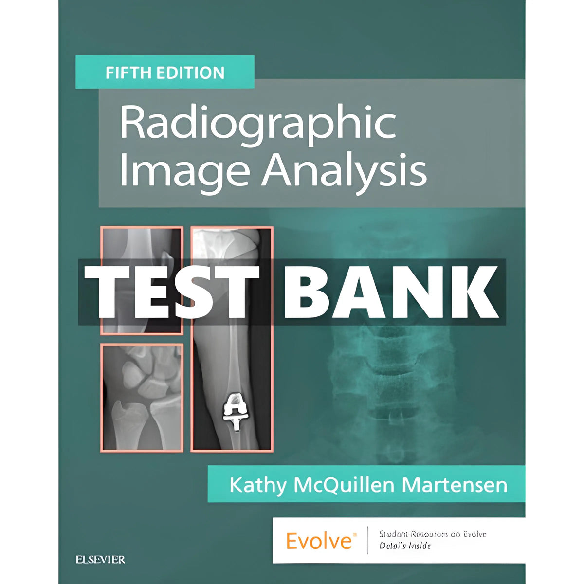 Radiographic Image Analysis 5th Edition by Martense | Test Bank