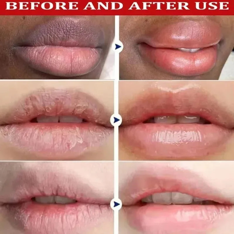 Fast Remove Dark Lip Balm Serum Lighten Melanin Lip Mask Exfoliating Fade Lines Dead Skin Nourishing Repair Lip Care Makeup
