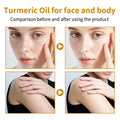 Turmeric Body Oil 200ml – Fast-Absorbing Natural Moisturizing Oil for Face & Body, Deep Hydration for All Skin Types