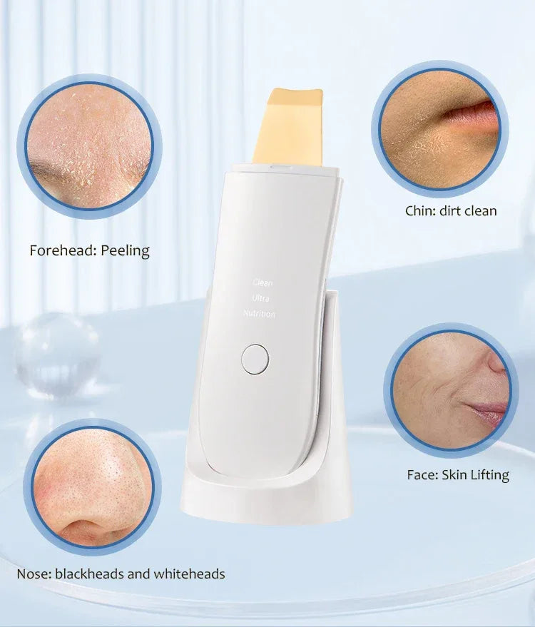 Ultrasonic Face Scrubber Facial Peeling Skin Scrubber Deep Facial Cleaning Spatula Acne Pore Ultrasonic Scrubber Facial Cleanser