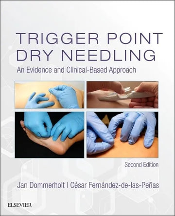 Trigger Point Dry Needling: An Evidence and Clinical Based Approach 2nd Edition by Dommerholt | Test Bank