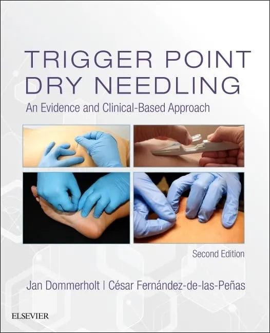 Trigger Point Dry Needling: An Evidence and Clinical Based Approach 2nd Edition by Dommerholt | Test Bank